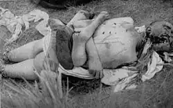 Une victime d'El Halia mutilée.