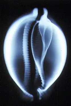 Radio de porcelaine.