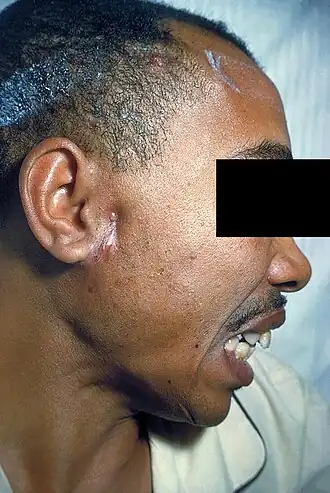 Description de cette image, également commentée ci-après