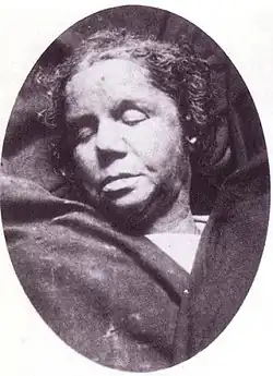 Photographie mortuaire en noir et blanc du visage d'une femme dans la quarantaine aux lèvres charnues.