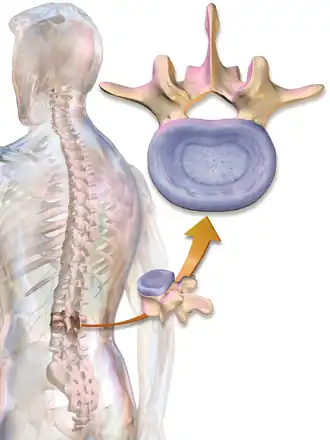 Schéma vertèbre et disque intervertébrale