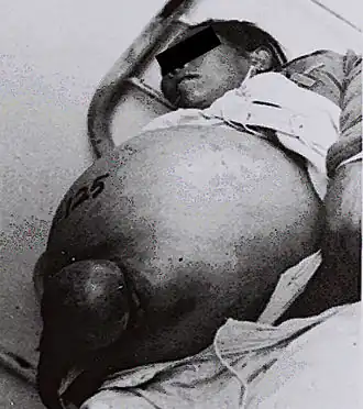 Description de l'image Assessment-of-morbidity-due-to-Schistosoma-japonicum-infection-in-China-2049-9957-3-6-9.jpg.