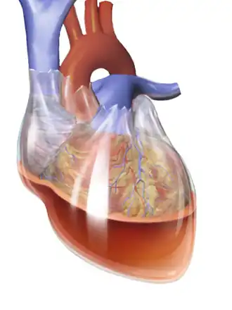Description de l'image Blausen 0164 CardiacTamponade 02.png.