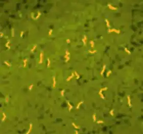 Description de l'image Borrelia duttoni.jpg.