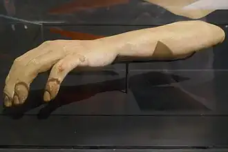 Une faux bras exposé dans une vitrine.