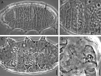 Description de l'image Bryodelphax kristenseni (10.3897-zookeys.703.12537) Figure 1.jpg.