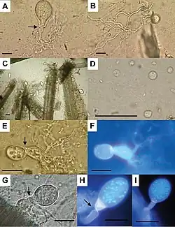 Buwchfawromyces eastonii (Neocallimastigomycota)