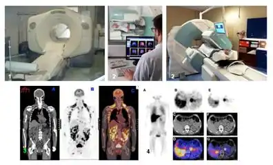 Caméras et images de médecine nucléaire