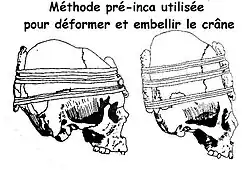 Méthode pré-Inca des planchettes