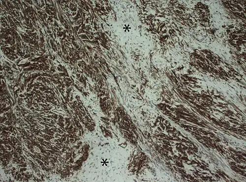 Champ de cellules d'apparence marbrée.