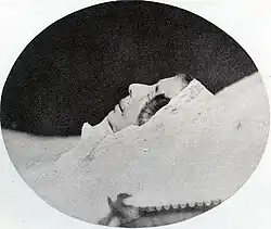 Photographie de la reine en 1860 sur son lit de mort.