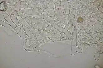 Poils de la face externe de l'apothécie.