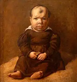 Nain assis inspiré de Vélasquez, école de Goya (début XIXe&nbsp;siècle).