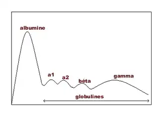 graphique présentant la courbe normale du dosage des protéines du plasma ayant migré dans un champ électrique