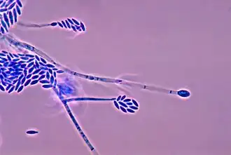 Description de l'image Fusarium verticillioides 01.jpg.