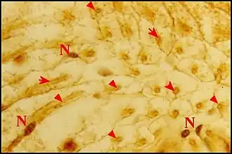photos macroscopique avec ajout de petite flèche indiquant des parties spécifiques de l'image