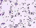 Diplocoques de S. pneumoniae