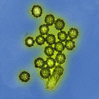 Description de l'image H1N1 Influenza Virus Particles (8411599236).jpg.