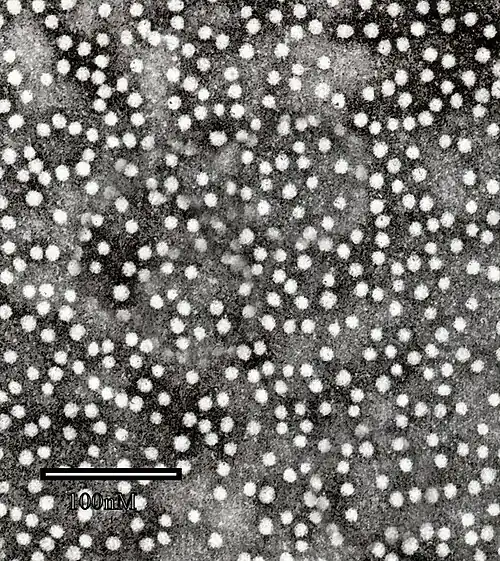 Microscopie électronique en transmission de l'antigène HBsAg du virus de l'hépatite B.
