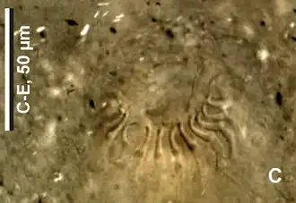 Épines de l'appareil copulateur mâle.