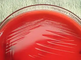 Description de l'image Kingella kingae PHIL12451.jpg.