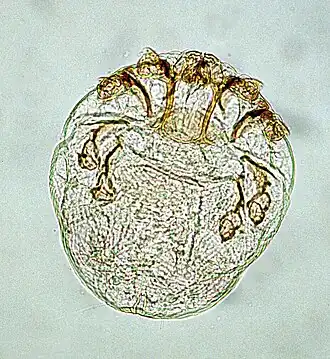 Description de l'image Knemidocoptes-mite.jpg.