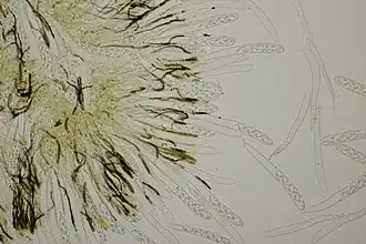 Paraphyses et asques