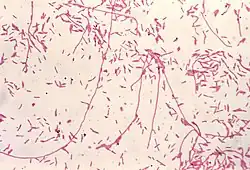 Coloration de Gram de Legionella pneumophila