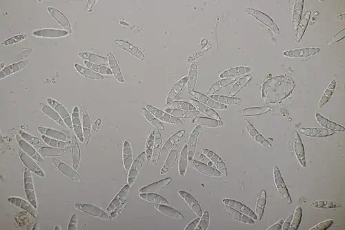 Leotia lubrica, ascospores multiguttulées