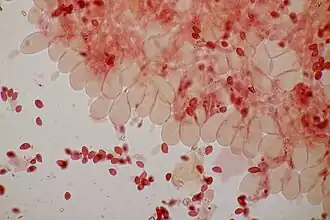 Cystides ampoulées des arrêtes des lames