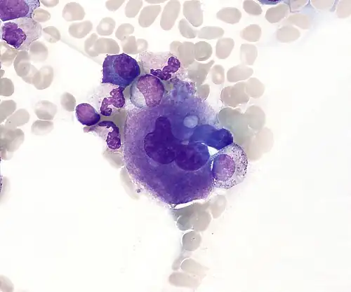 Un mégacaryocyte (cliché obtenu par microscopie optique)