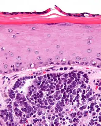 Description de cette image, également commentée ci-après