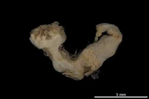 Protrochus bruuni (Myriotrochidae).