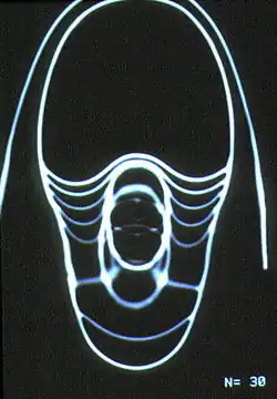 Image de nautile en scanographie axiale.