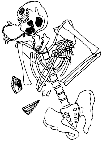 Dessin d'os formant un squelette partiel sans crâne (sauf mâchoire inférieure), ni jambe, ni main gauche, avec 2 éclats.