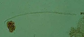 Description de l'image Onchocerca volvulus mf1 DPDx.JPG.