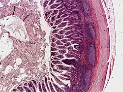 Coupe transversale de l'iléon avec un patch de Peyer encerclé.