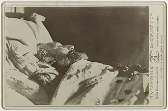 Photographie d'un homme sur son lit de mort.