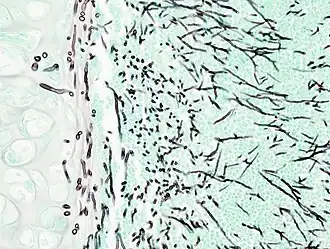 Description de cette image, également commentée ci-après