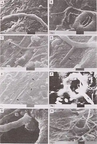 Description de l'image Recent research on foliage diseases - conference proceedings - Carlisle, Pennsylvania, May 29-June 2, 1989 (1990) (20385379308).jpg.