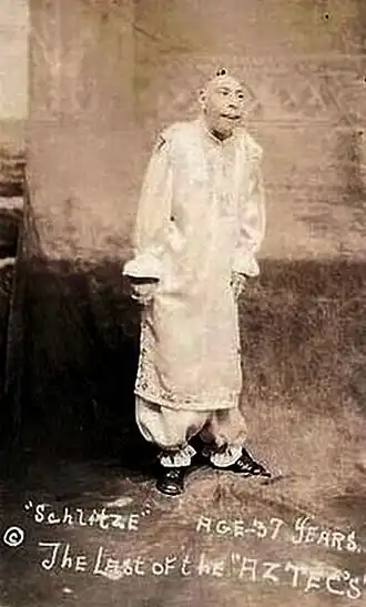 Schlitzie (1901-1971).