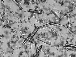 Cristaux de struvite dans une urine humaine de pH 9. On observe aussi de nombreux cristaux xénomorphes, plusieurs cellules épithéliales (squameuses et non squameuses) et quelques leucocytes.