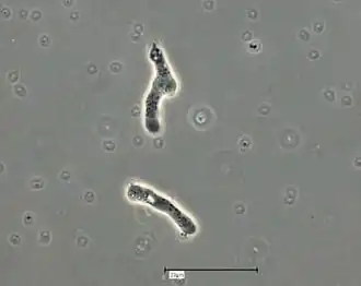 Trophozoites, morphologie monopodiale typique.Saline amibienne. Contraste de phase.Barre (échelle) : 20 µm.