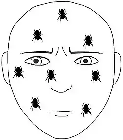 Image illustrative de l’article Paresthésie