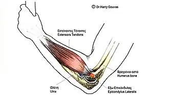 Description de l'image Tennis Elbow Anatomy.jpg.