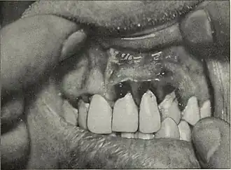 Description de cette image, également commentée ci-après