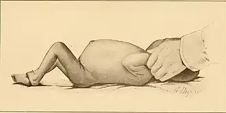 Description de l'image The diseases of infancy and childhood (1910) (14761683704).jpg.