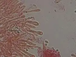  Photographie au microscope dont la préparation est teintée de rouge. Des tubes emmêlés se terminent par des boursouflures en forme de massue contenant parfois une forme sphérique ou ovoïde. L'une de ses boursouflures porte quatre dents