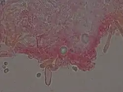  Photographie au microscope d'une masse informe colorée de rouge. Se dégage de cette masse, une sorte de tube gonflé