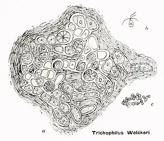 Description de l'image Trichophilus welckeri in Coupin, Album général des Cryptogames, Pl. 78.jpg.